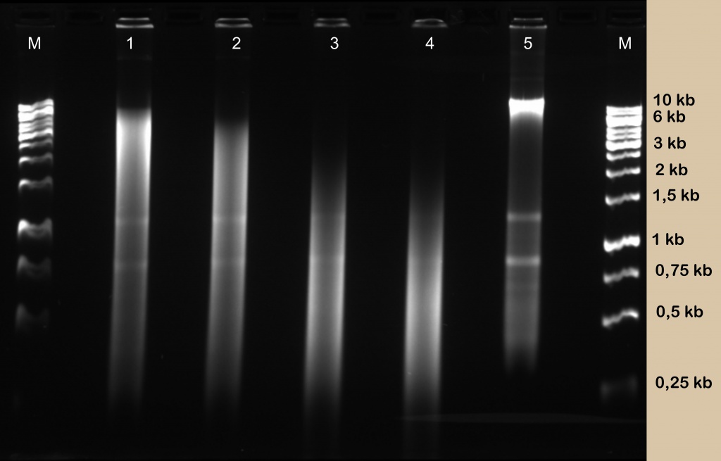 Diagenode_yeast_DNA.jpg